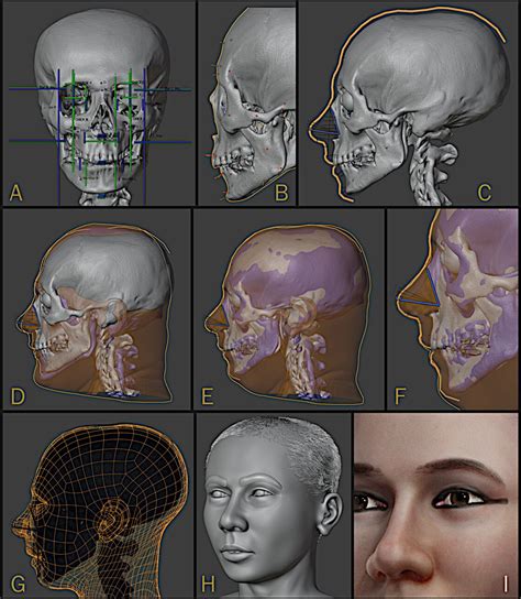 Comparaison d'un crâne et de sa reconstitution faciale 3D