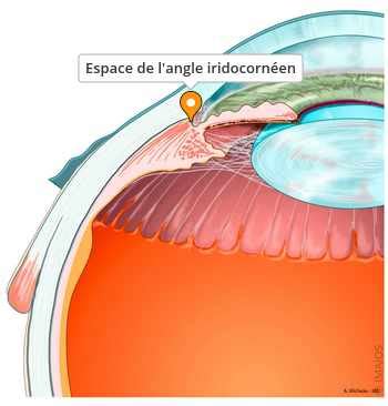 Schéma des différentes structures de l'angle iridocornéen.