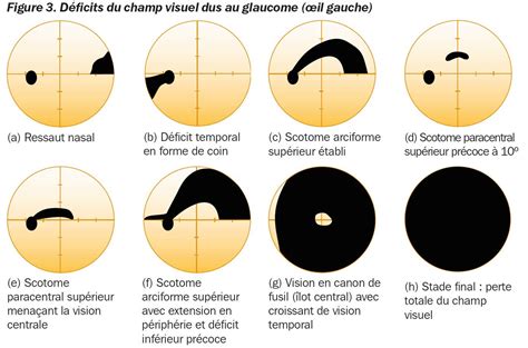 Exemple visuel de différentes profondeurs de champ avec des F-Stops variés