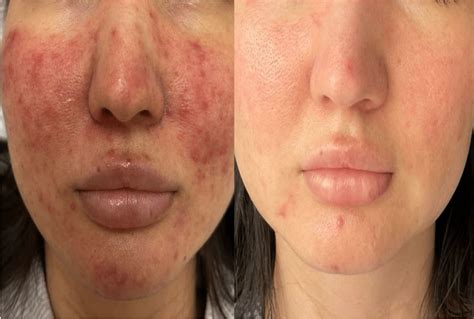 Illustration du résultat après application de l'image et du masque associés