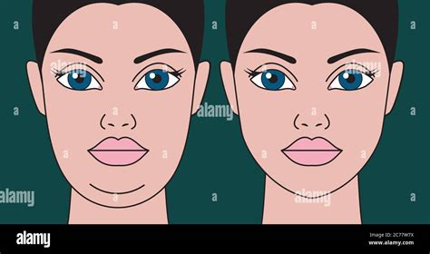 Schéma illustrant la détection des contours du visage et la réduction du double menton par IA