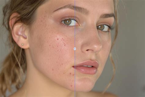 Comparaison avant/après de l'utilisation de l'outil Correcteur de tache pour supprimer des imperfections sur un portrait