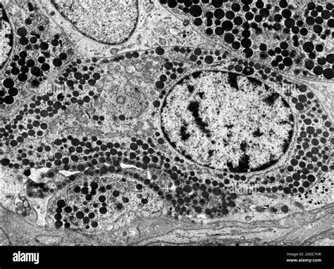 Micrographie électronique de nanoparticules de cellulose