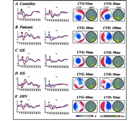 Illustration montrant la superposition de tracés générés par Potrace pour reconstituer une image couleur.